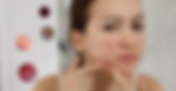 Acne & The Skin Microbiome?