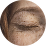 Skin-Elasticity.